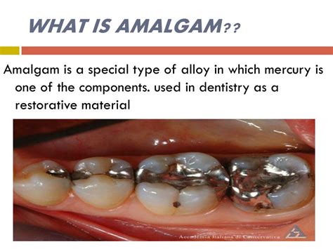 amalgam synonym|Amalgam Definition & Meaning .